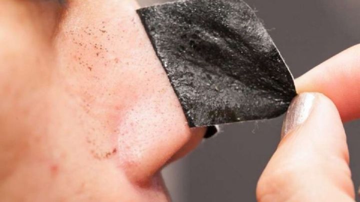 Elimina de forma efectiva los puntos negros y espinillas con esta mascarilla casera y natural