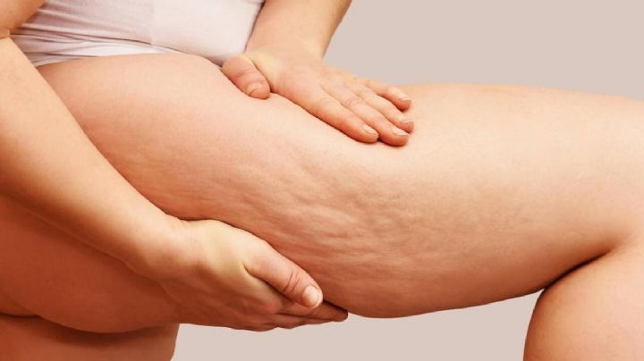 Secretos de belleza: 10 aspectos que deberías conocer de la celulitis para combatirla con eficacia