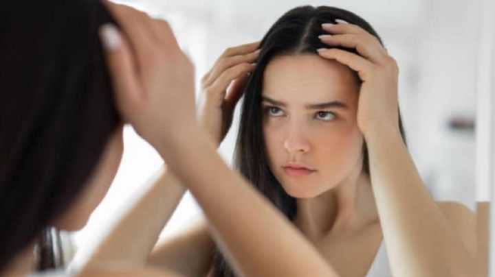 Cabello: tips para eliminar la caspa