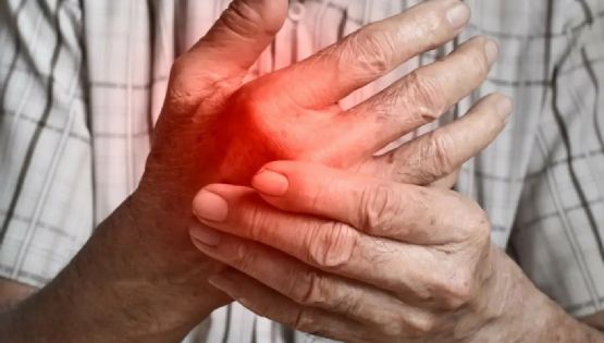 Parestesia: Descubre los 6 motivos detrás del hormigueo en tus manos