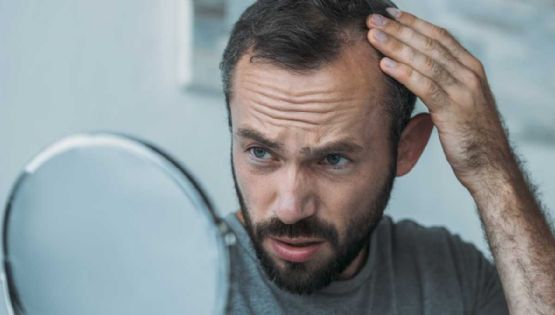 Un futuro sin calvicie: la terapia innovadora que podría cambiarlo todo