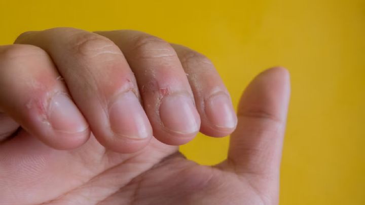 Cuida tus uñas y di adiós al dolor: 7 soluciones efectivas