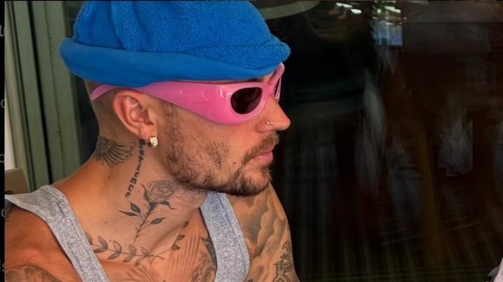 La Lucha de Justin Bieber: Entendiendo el Síndrome de Ramsay Hunt